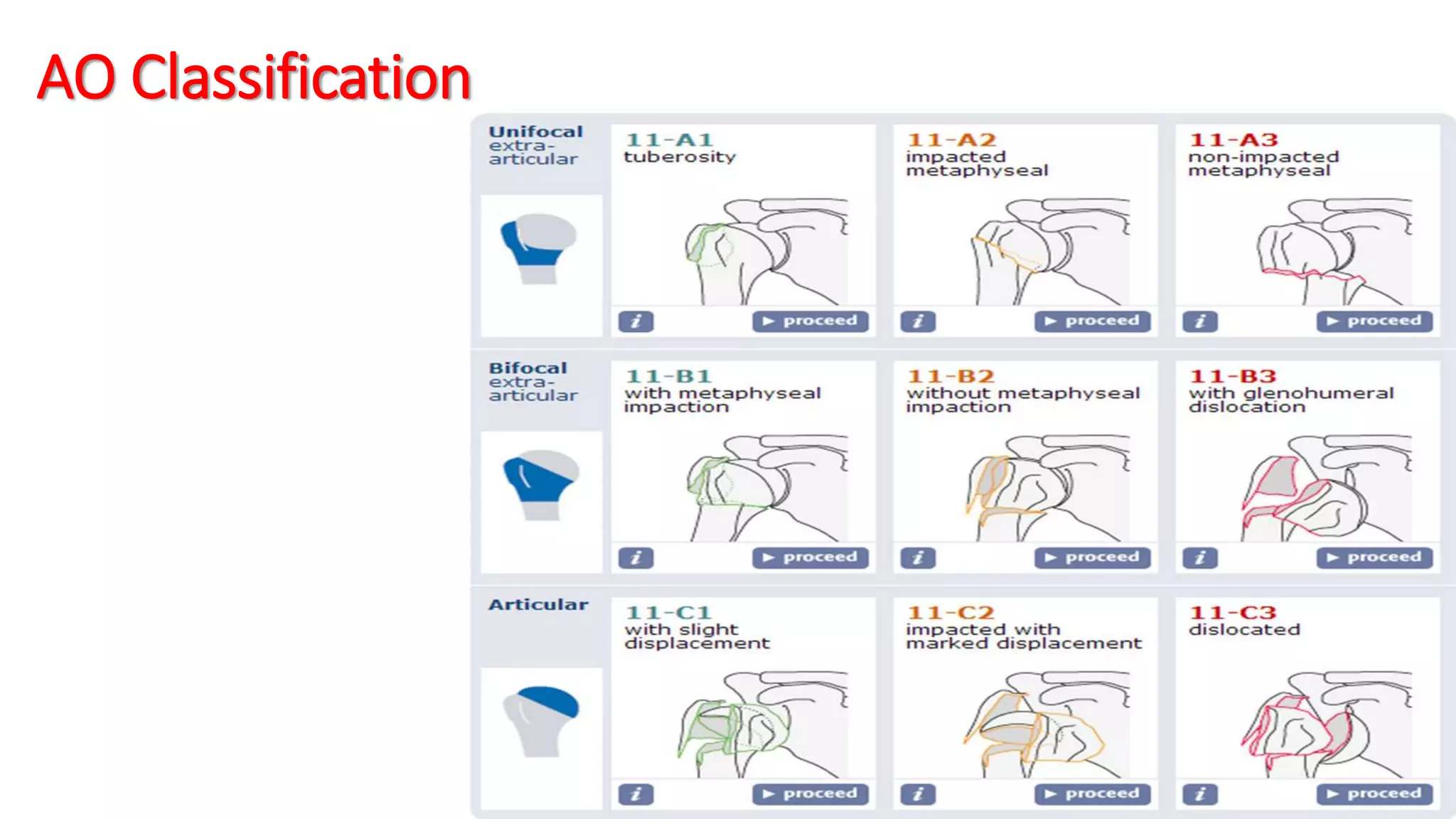 Fractures of the proximal humerus | PPTX