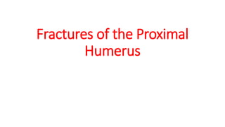 Fractures of the Proximal
Humerus
 