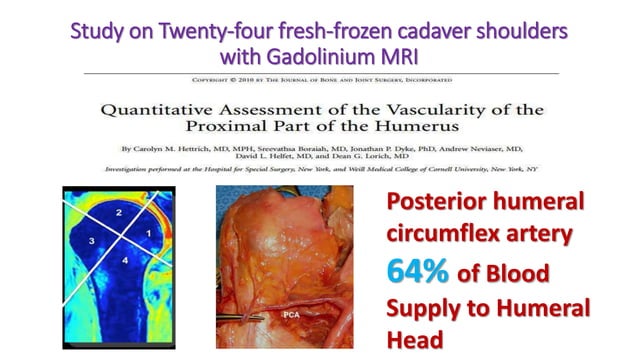 Fractures of the proximal humerus | PPT