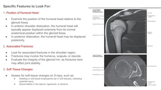 Specific Features to Look For:
1. Position of Humeral Head:
● Examine the position of the humeral head relative to the
glenoid fossa.
● In anterior shoulder dislocation, the humeral head will
typically appear displaced anteriorly from its normal
anatomical position within the glenoid fossa.
● In posterior dislocation, the humeral head may be displaced
posteriorly.
2. Associated Fractures:
● Look for associated fractures in the shoulder region.
● Fractures may involve the humerus, scapula, or clavicle.
● Evaluate the integrity of the glenoid rim, as fractures here
may affect joint stability.
3. Soft Tissue Changes:
● Assess for soft tissue changes on X-rays, such as:
● Swelling or soft tissue emphysema (air in soft tissues), indicating
potential injury.
● Abnormalities in the labrum, ligaments, or tendons.
 