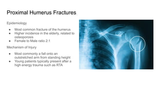 Proximal Humerus Fractures
Epidemiology
● Most common fracture of the humerus
● Higher incidence in the elderly, related to
osteoporosis
● Female to Male ratio 2:1
Mechanism of Injury
● Most commonly a fall onto an
outstretched arm from standing height
● Young patients typically present after a
high energy trauma such as RTA
 