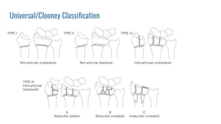 Universal/Clooney Classiﬁcation
 