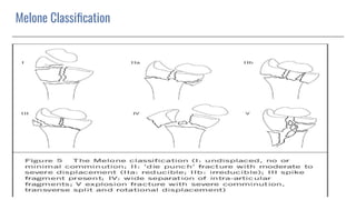 Melone Classiﬁcation
 