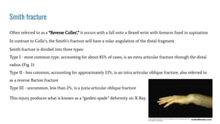 Smith fracture
Often referred to as a “Reverse Colles’,” it occurs with a fall onto a ﬂexed wrist with forearm ﬁxed in supination
In contrast to Colle’s, the Smith’s fracture will have a volar angulation of the distal fragment.
Smith fracture is divided into three types:
Type I - most common type, accounting for about 85% of cases, is an extra articular fracture through the distal
radius (Fig. 1)
Type II - less common, accounting for approximately 13%, is an intra articular oblique fracture, also referred to
as a reverse Barton fracture
Type III - uncommon, less than 2%, is a juxta-articular oblique fracture
This injury produces what is known as a “garden-spade” deformity on X-Ray.
 