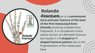 FRACTURES OF THE WRIST AND HAND break in the bones.pptx