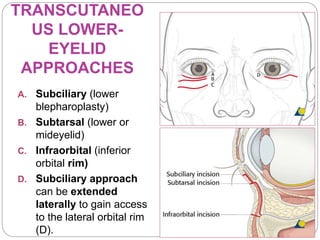 Subciliary Approach Incision FRACTURES OF THE ZYGOMATIC COMPLEX AND ORBIT.pptx.pptx