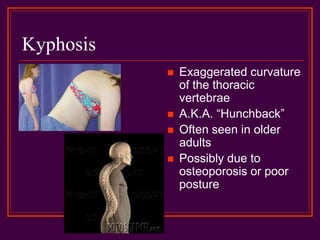 Kyphosis
 Exaggerated curvature
of the thoracic
vertebrae
 A.K.A. “Hunchback”
 Often seen in older
adults
 Possibly due to
osteoporosis or poor
posture
 