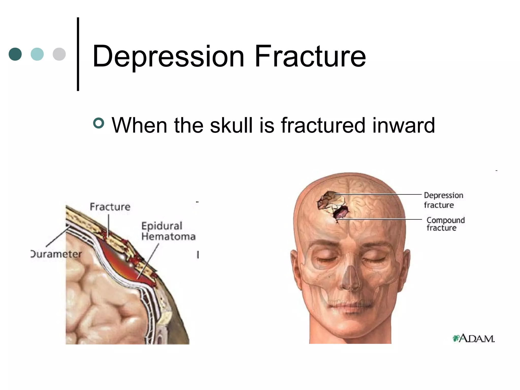 Fractures sprains and dislocations | PPS