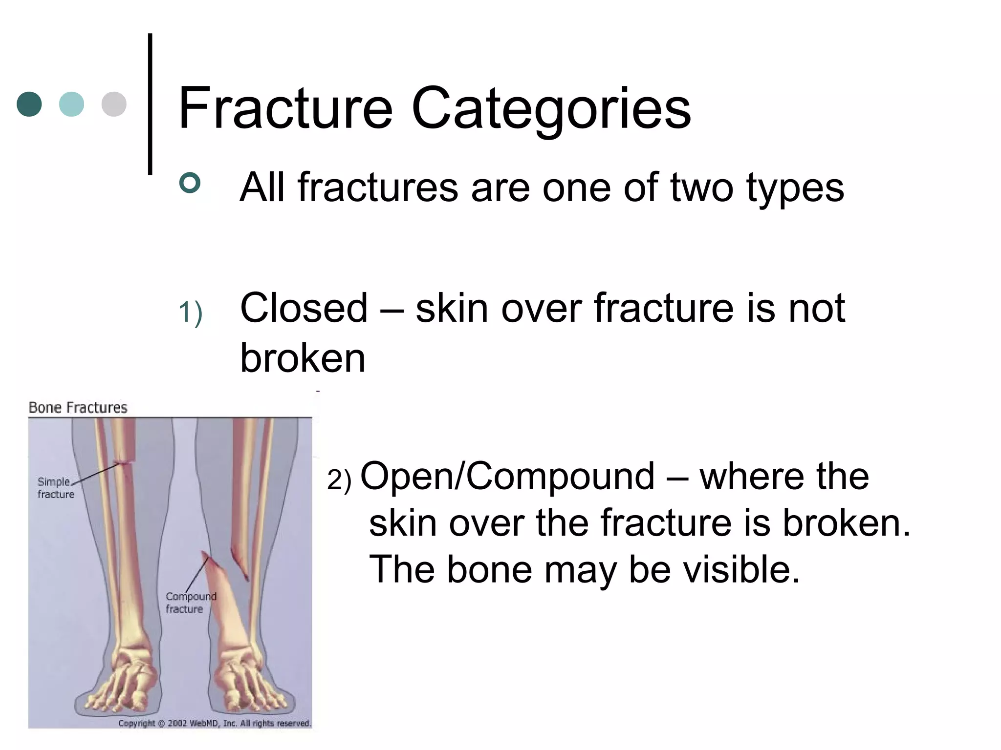 Fractures sprains and dislocations | PPS