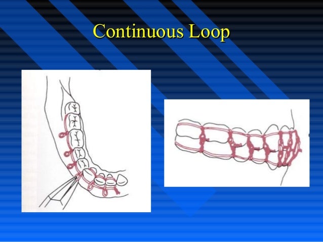 Continuous loop wiring