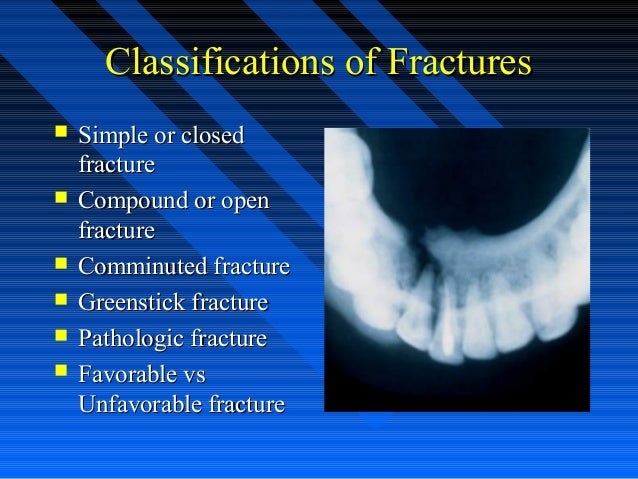 open vs closed fracture open vs closed fracture