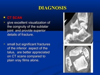 DIAGNOSISDIAGNOSIS
 CT SCANCT SCAN
 give excellent visualization ofgive excellent visualization of
the congruity of the subtalarthe congruity of the subtalar
joint and provide superiorjoint and provide superior
details of fracture.details of fracture.
 small but significant fracturessmall but significant fractures
of the inferior aspect of theof the inferior aspect of the
talus, are better appreciatedtalus, are better appreciated
on CT scans compared toon CT scans compared to
plain xray films alone.plain xray films alone.
 