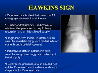 HAWKINS SIGNHAWKINS SIGN
 Osteonecrosis is identified based on AP
radiograph between 6 and 8 week
 Subchondral lucency is indicative of
relative osteopenia secondary to bony
resorption and an intact blood supply
Progresses from medial to lateral due to
vascular re-establishing from medial side of
dome through deltoid ligament
 Indicative of diffuse osteopenia with
vascular congestion suggests continuity of
blood supply.
However the presence of sign doesn’t rule
out the Osteonecrosis, its absence also not
diagnostic for Osteonecrosis.
 