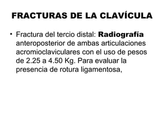 FRACTURAS DE LA CLAVÍCULA
• Fractura del tercio distal: Radiografía
anteroposterior de ambas articulaciones
acromioclaviculares con el uso de pesos
de 2.25 a 4.50 Kg. Para evaluar la
presencia de rotura ligamentosa,
 