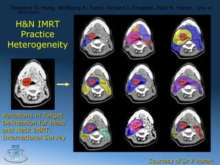 Theodore S. Hong, Wolfgang A. Tomé, Richard J. Chappell, Paul M. Harari, Univ of
     Wisconsin


  H&N IMRT
    Practice
 Heterogeneity




Variations in Target
Delineation for Head
and Neck IMRT:
International Survey
  2012




                                                        Courtesy of Dr P Harari
 