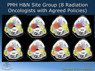 PMH H&N Site Group (8 Radiation
  Oncologists with Agreed Policies)




2012




                        Courtesy of Dr J Waldron
 