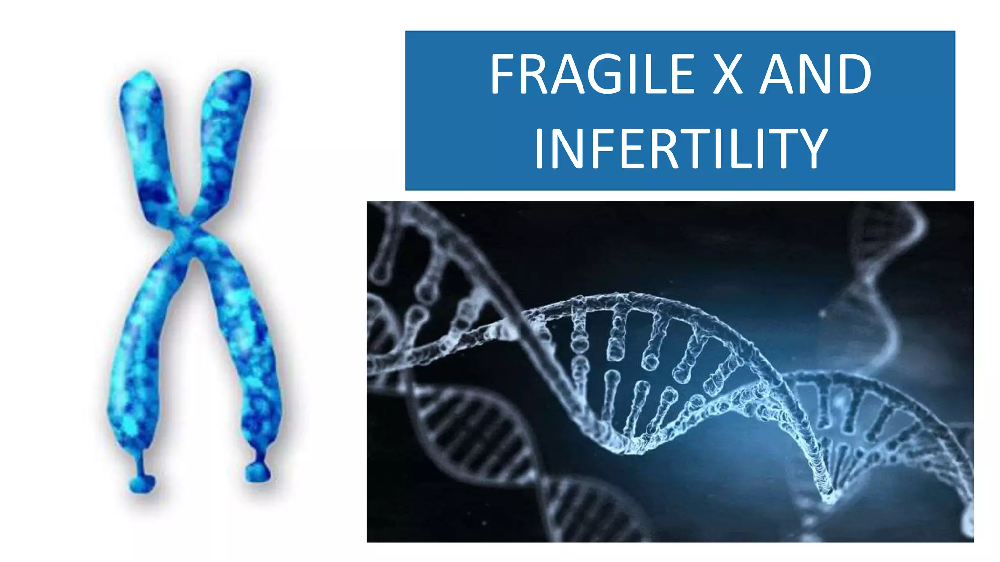 Fragile X Syndrome and Infertility | PPTX