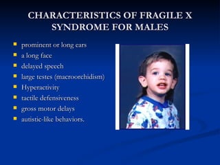 CHARACTERISTICS OF FRAGILE X SYNDROME FOR MALES ,[object Object],[object Object],[object Object],[object Object],[object Object],[object Object],[object Object],[object Object]