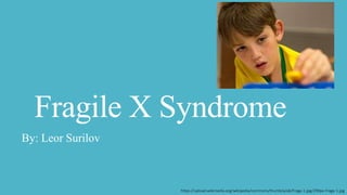 Fragile X Syndrome
By: Leor Surilov
https://upload.wikimedia.org/wikipedia/commons/thumb/a/ab/Fragx-1.jpg/290px-Fragx-1.jpg
 