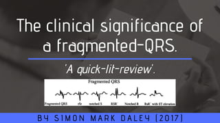 The clinical significance of
a fragmented-QRS.
B Y S I M O N M A R K D A L E Y ( 2 0 1 7 )
'A quick-lit-review'.
 