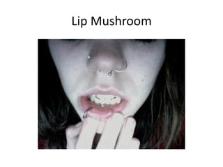 Lip Mushroom