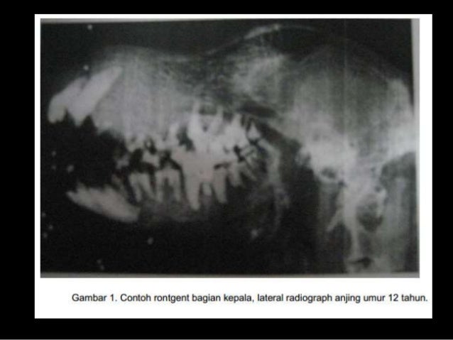 Interpretasi Radiografi Adalah - Prinsip Reposisi, Fiksasi Dan