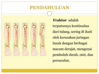 Fraktur tibia | PPTX