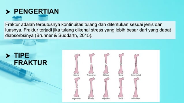 Fraktur tibia fisiologi anatomy assessmrnt | PDF
