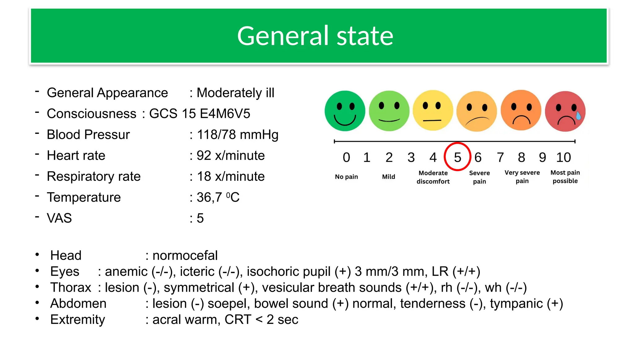 fraktur tibia fibula 2.pptx fraktur tibia fibula 2.pptx