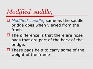 Modified saddle,
 Modified saddle, same as the saddle
bridge does when viewed from the
front.
 The difference is that th...