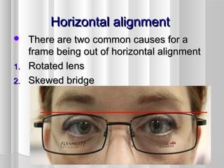 Horizontal alignmentHorizontal alignment
 There are two common causes for aThere are two common causes for a
frame being out of horizontal alignmentframe being out of horizontal alignment
1.1. Rotated lensRotated lens
2.2. Skewed bridgeSkewed bridge
 
