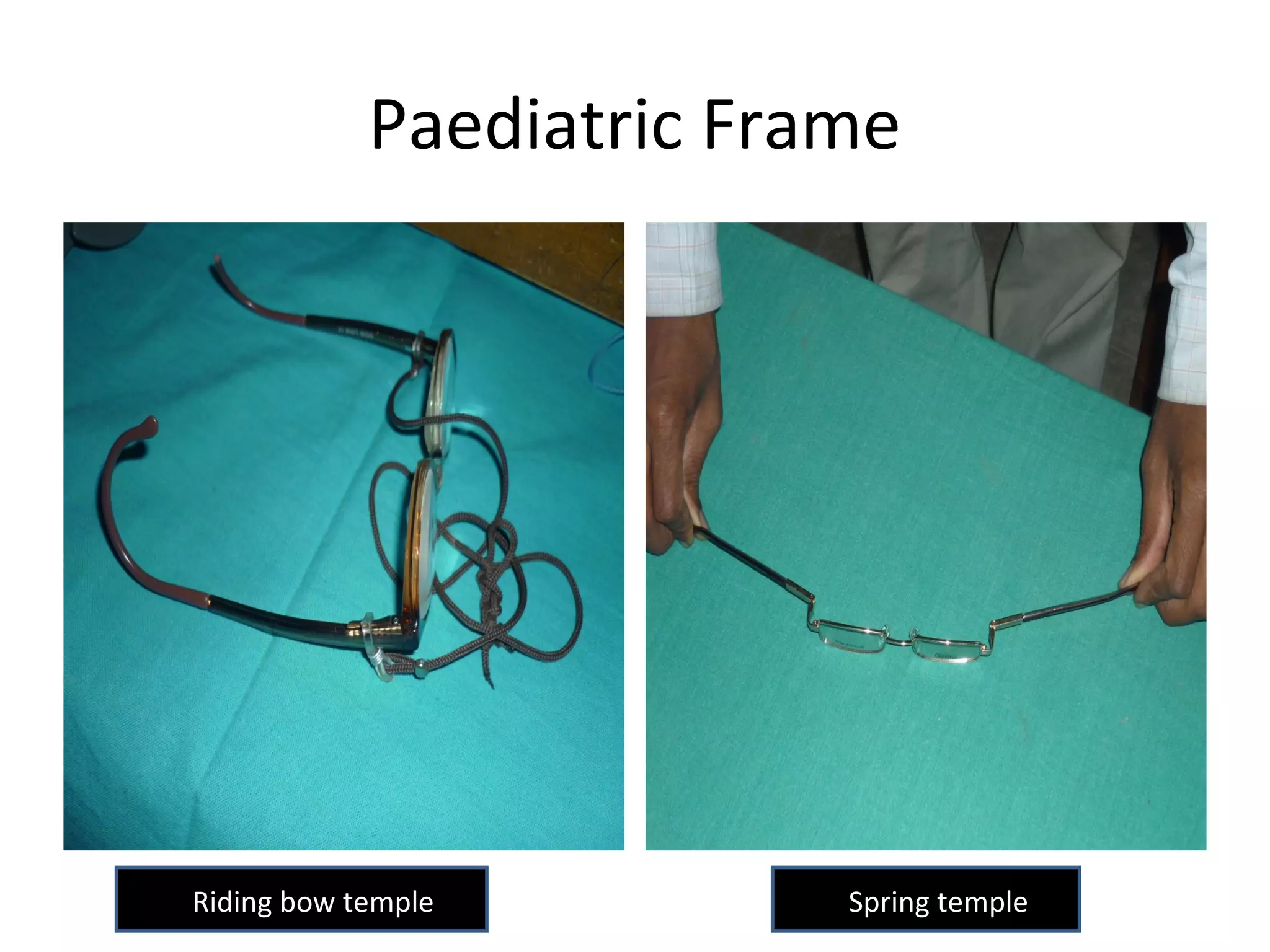 Paediatric Frame
Spring templeRiding bow temple
 