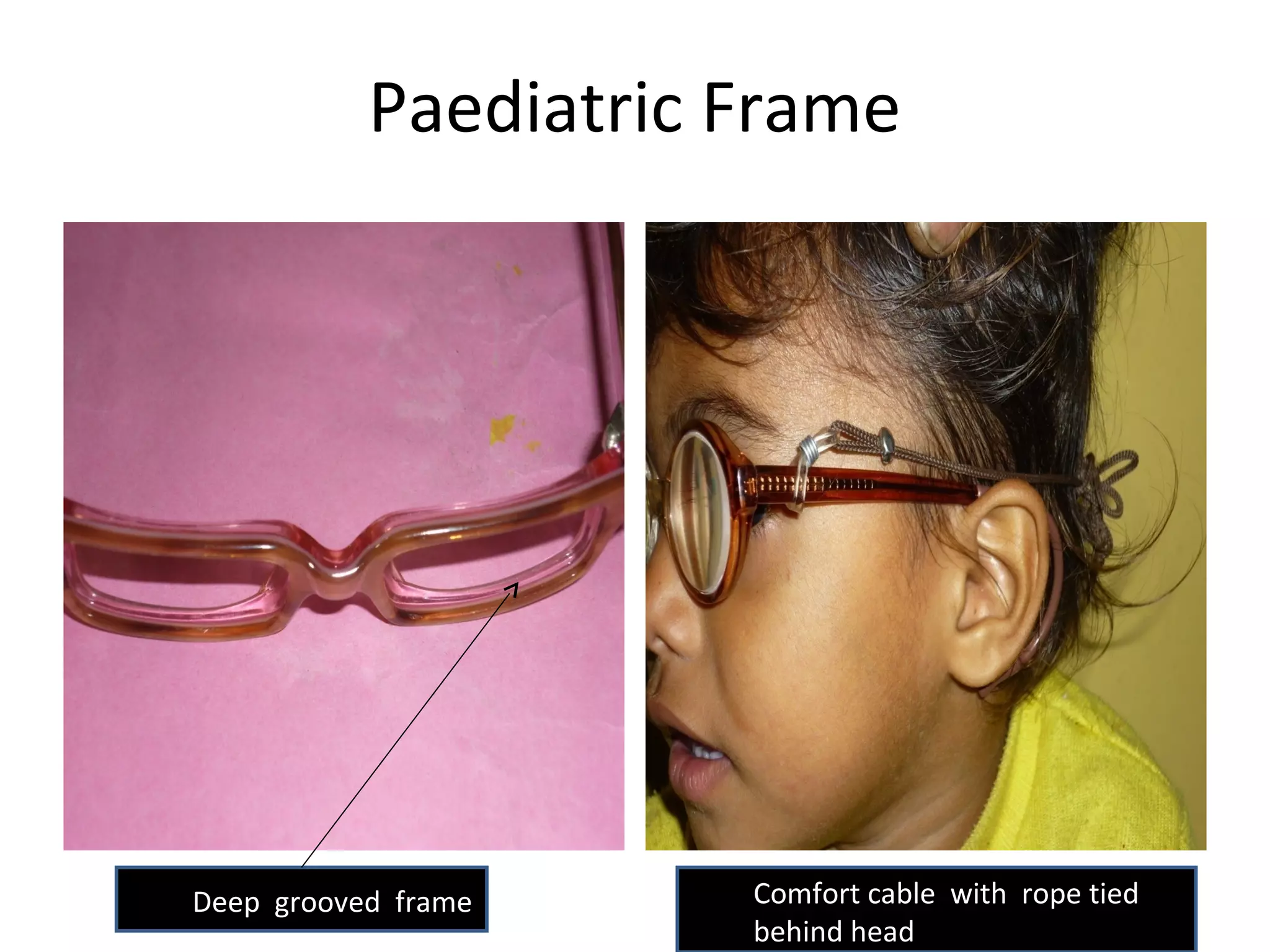 Paediatric Frame
Deep grooved frame Comfort cable with rope tied
behind head
 