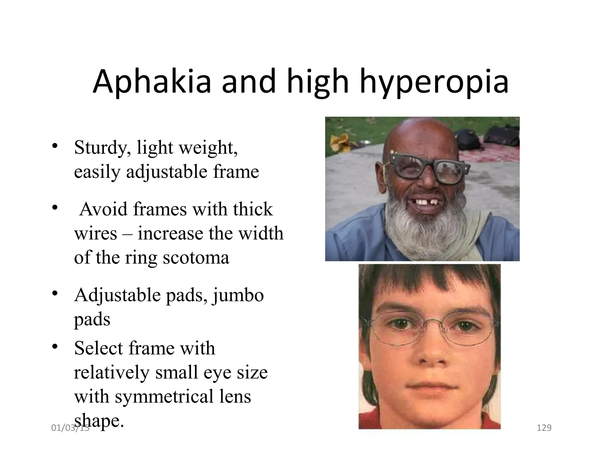 Aphakia and high hyperopia
• Sturdy, light weight,
easily adjustable frame
• Avoid frames with thick
wires – increase the width
of the ring scotoma
• Adjustable pads, jumbo
pads
• Select frame with
relatively small eye size
with symmetrical lens
shape.01/03/15 129
 