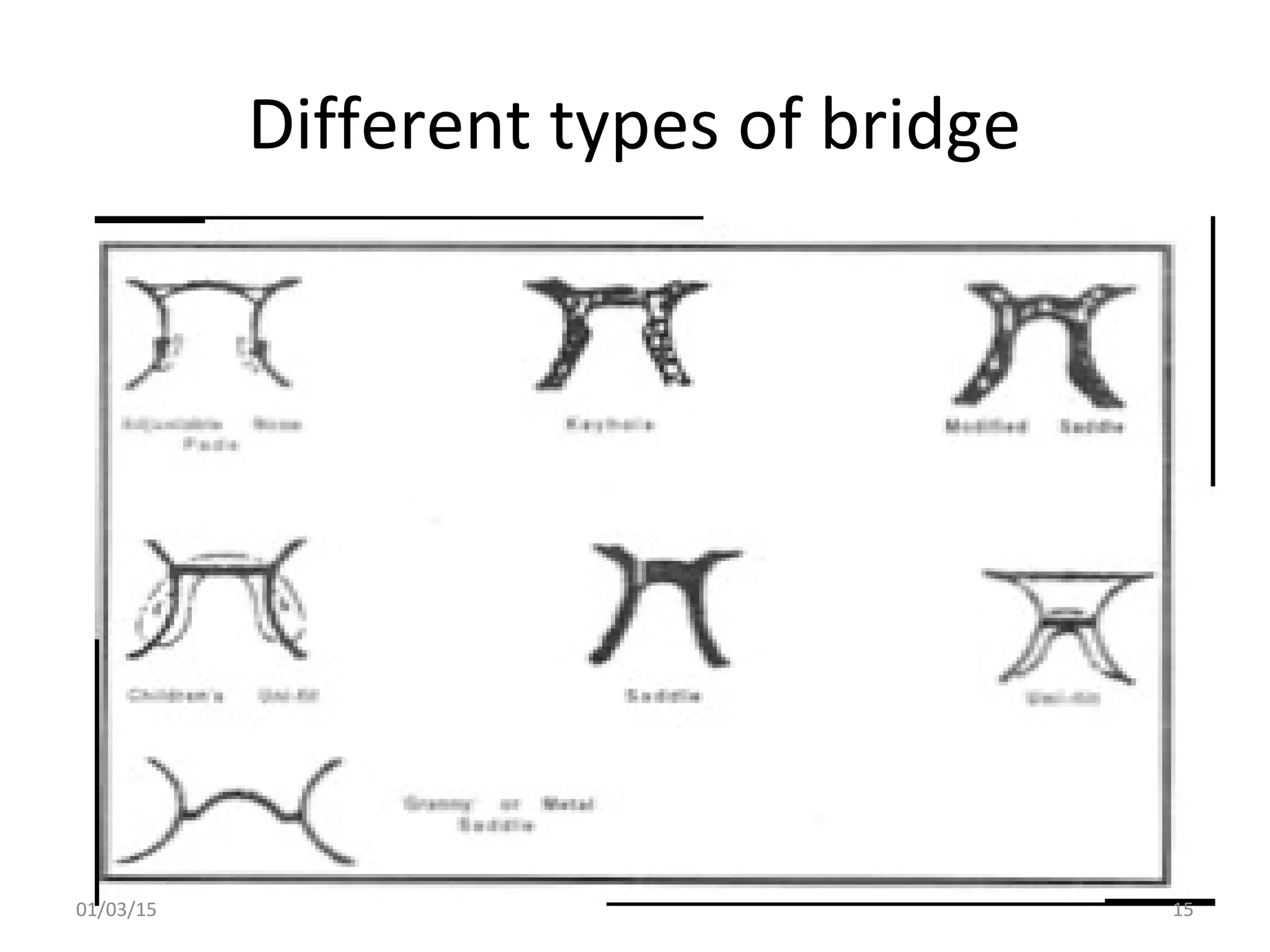 Different types of bridge
01/03/15 15
 