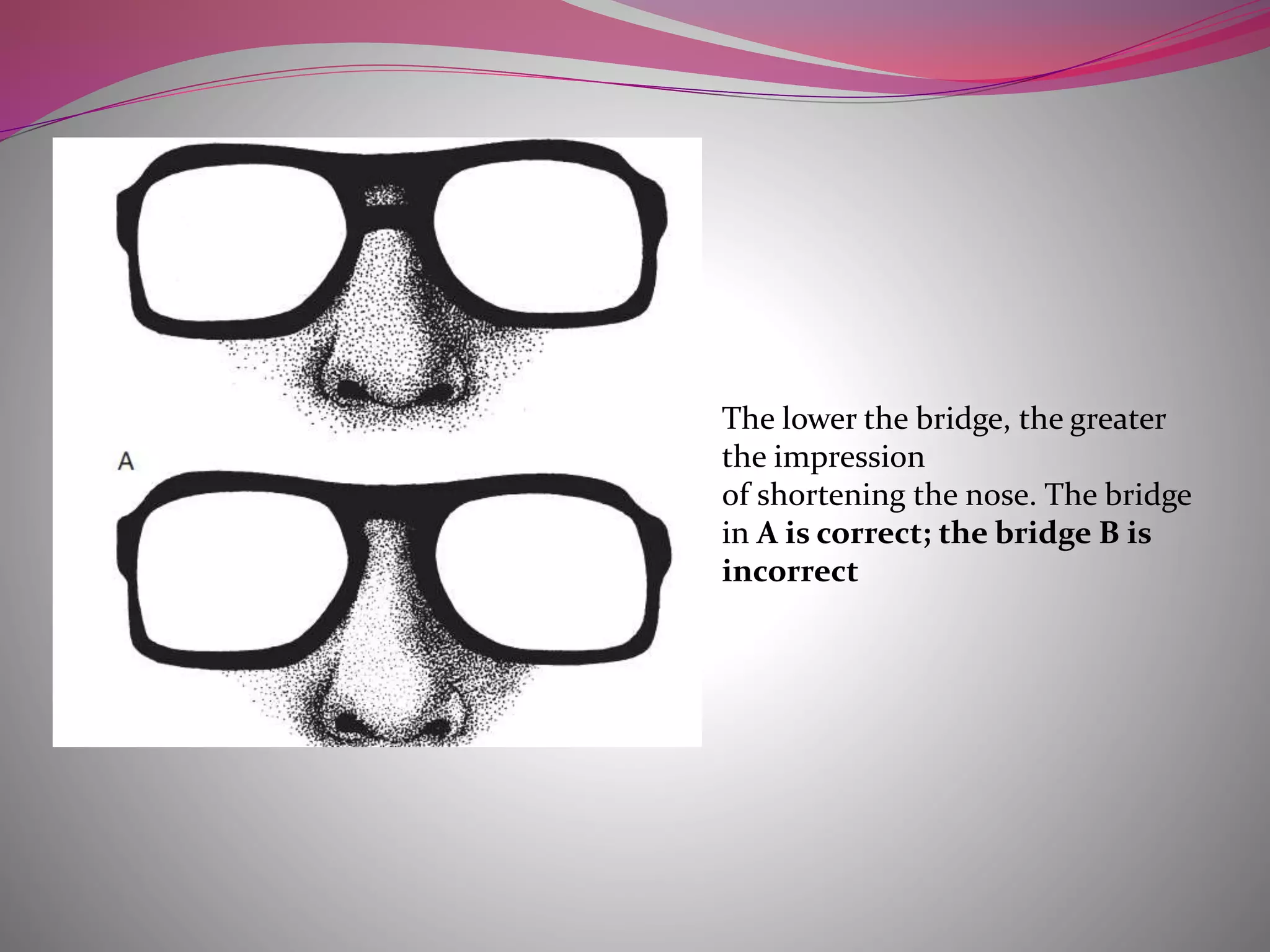 The lower the bridge, the greater
the impression
of shortening the nose. The bridge
in A is correct; the bridge B is
incorrect
 