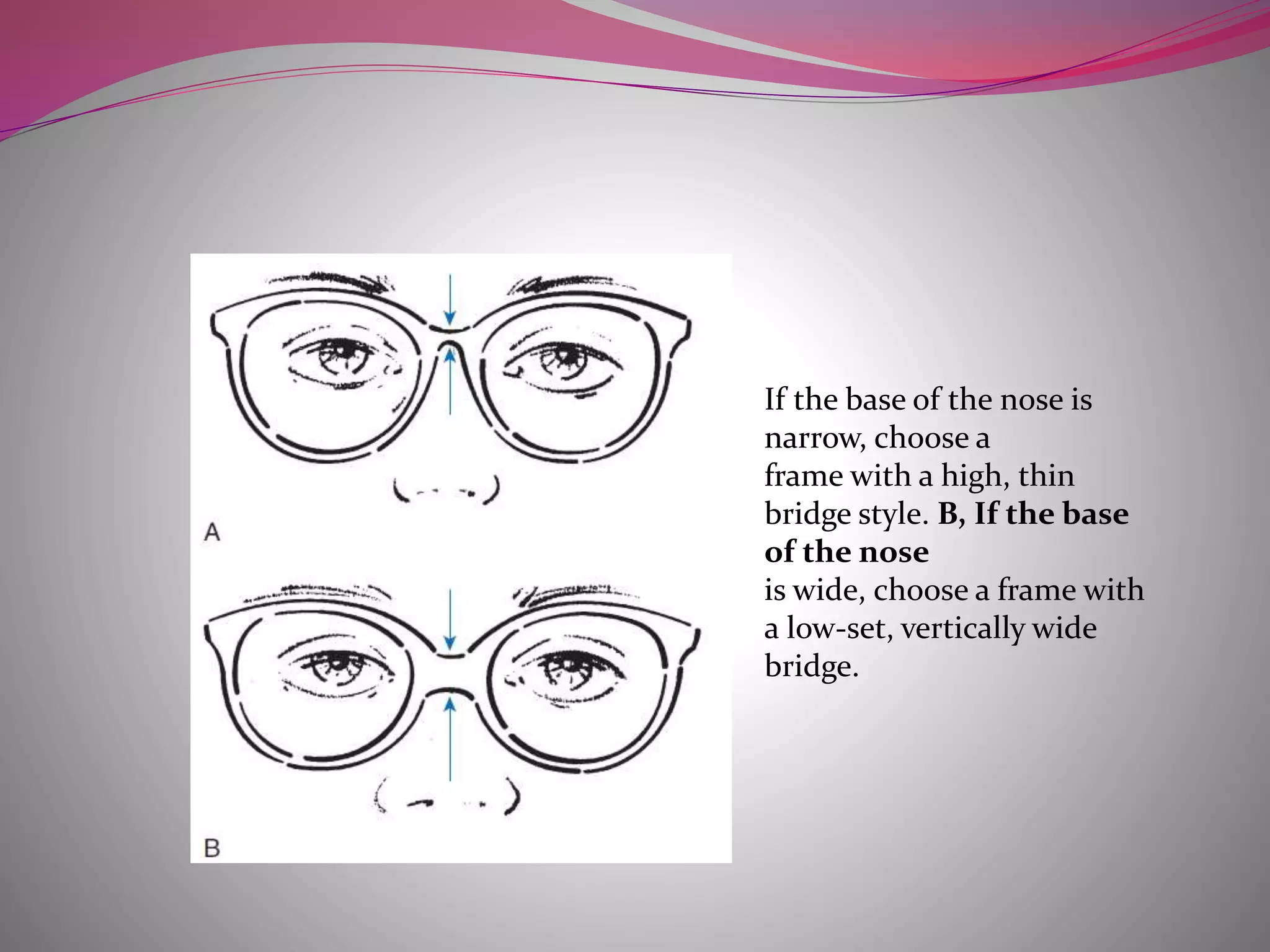 If the base of the nose is
narrow, choose a
frame with a high, thin
bridge style. B, If the base
of the nose
is wide, choose a frame with
a low-set, vertically wide
bridge.
 