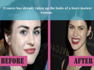 Frances Bean Cobain Plastic Surgery frances-bean-cobain-plastic-surgery