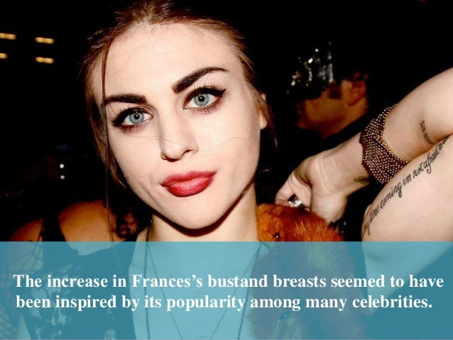 frances bean cobain plastic surgery