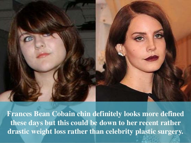 frances bean cobain plastic surgery