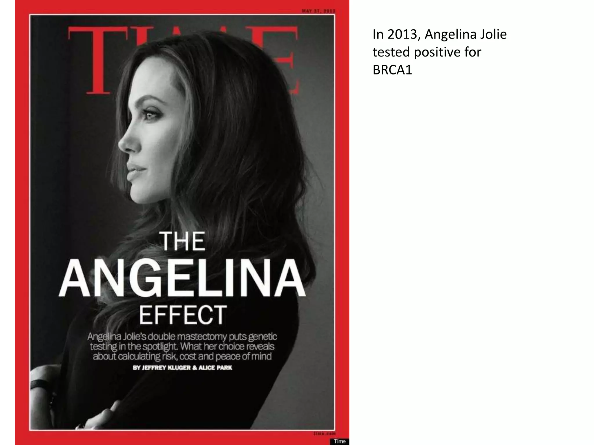 In 2013, Angelina Jolie
tested positive for
BRCA1
 