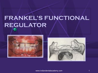 FRANKEL’S FUNCTIONAL
REGULATOR

www.indiandentalacademy.com

1

 