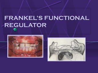 FRANKEL’S FUNCTIONAL
REGULATOR
 