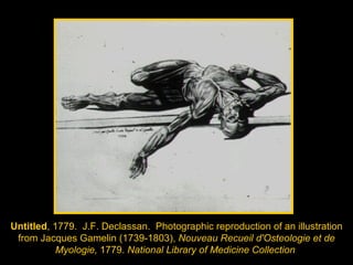 Untitled , 1779.  J.F. Declassan.  Photographic reproduction of an illustration from Jacques Gamelin (1739-1803),  Nouveau Recueil d'Osteologie et de Myologie,  1779.  National Library of Medicine Collection   