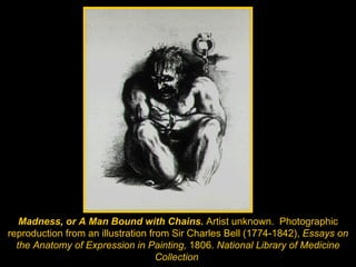 Madness, or A Man Bound with Chains.  Artist unknown.  Photographic reproduction from an illustration from Sir Charles Bell (1774-1842),  Essays on the Anatomy of Expression in Painting,  1806.  National Library of Medicine Collection   