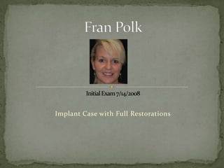 Implant Case with Full Restorations
 