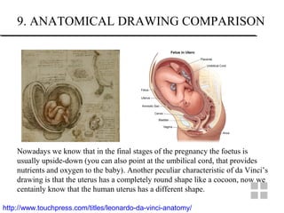 9. ANATOMICAL DRAWING COMPARISON
http://www.touchpress.com/titles/leonardo-da-vinci-anatomy/
Nowadays we know that in the final stages of the pregnancy the foetus is
usually upside-down (you can also point at the umbilical cord, that provides
nutrients and oxygen to the baby). Another peculiar characteristic of da Vinci’s
drawing is that the uterus has a completely round shape like a cocoon, now we
centainly know that the human uterus has a different shape.
 