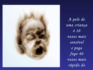 A pele de
uma criança
     é 10
 vezes mais
  sensível
    e pega
   fogo 40
 vezes mais
 rápido do
 
