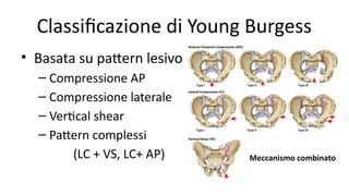 Pattern Di Compressione sacral and pelvic fracture: characteristics and classifications | PPTX