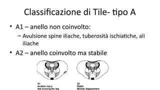 Sac Rating Classifications sacral and pelvic fracture: characteristics and classifications | PPTX